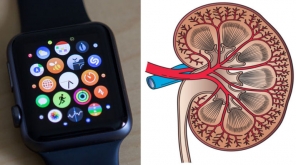 Apple Watch Warned Kidney Failure Of Florida Girl Saving Her Life